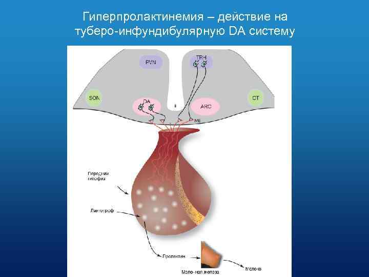 Гиперпролактинемия – действие на туберо-инфундибулярную DA систему 