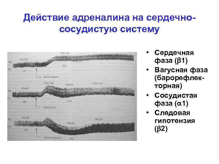 Действие адреналина на сердечнососудистую систему • Сердечная фаза ( 1) • Вагусная фаза (барорефлекторная)
