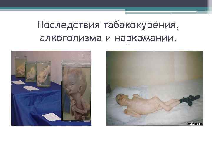 Последствия табакокурения, алкоголизма и наркомании. 