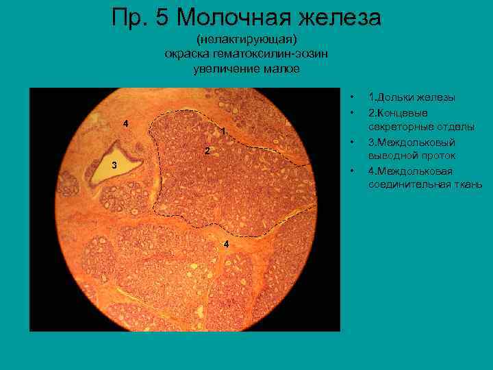 Пр. 5 Молочная железа (нелактирующая) окраска гематоксилин-эозин увеличение малое • • 4 1 2