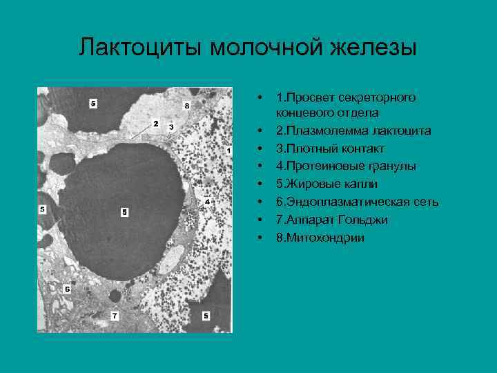 Клетки молочной железы. Лактоциты молочной железы. Молочная железа апокриновый Тип. Секреторный отдел молочной железы. Концевые секреторные отделы молочной железы.