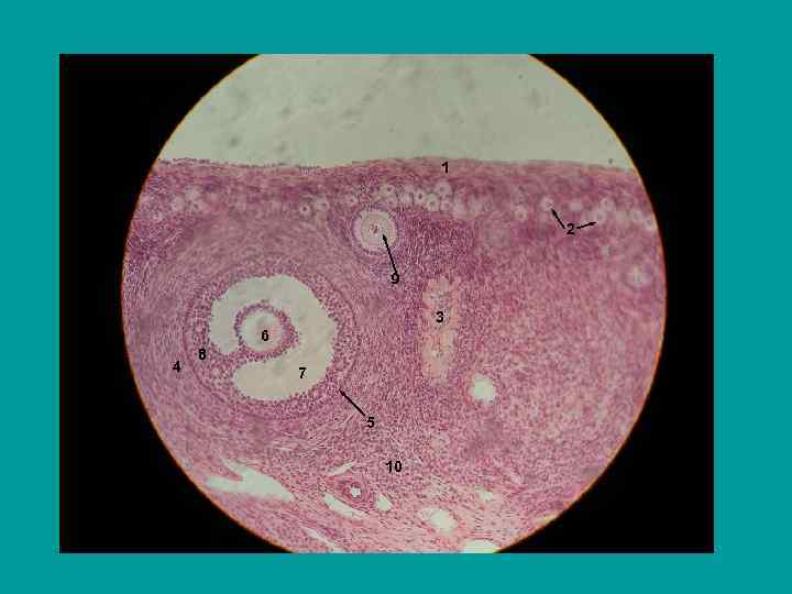 1 2 9 3 6 4 8 7 5 10 