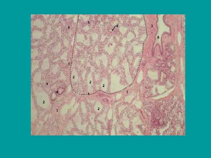 5 4 5 3 6 3 2 2 5 4 2 3 1 2