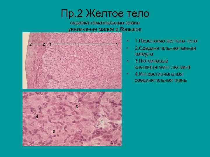 Пр. 2 Желтое тело окраска гематоксилин-эозин увеличение малое и большое 2 2 1 1