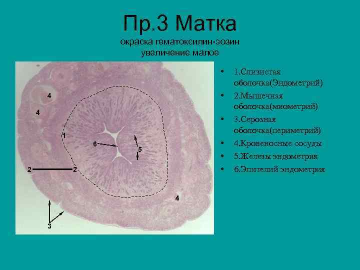 Пр. 3 Матка окраска гематоксилин-эозин увеличение малое • • 4 4 • 1 6