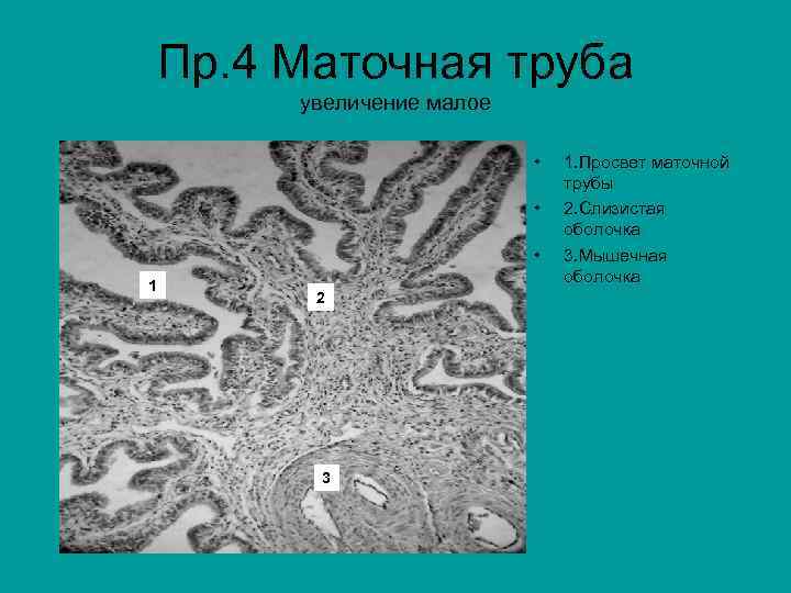 Пр. 4 Маточная труба увеличение малое • • • 1 2 3 1. Просвет