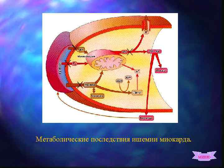 Метаболические последствия ишемии миокарда. МЕНЮ 