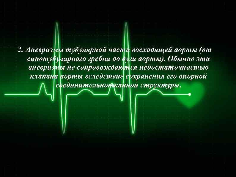 2. Аневризмы тубулярной части восходящей аорты (от синотубулярного гребня до дуги аорты). Обычно эти