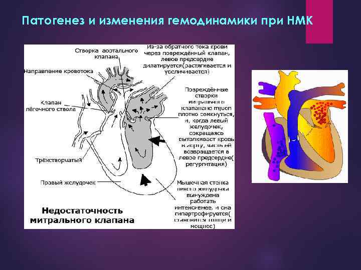 Патогенез и изменения гемодинамики при НМК 