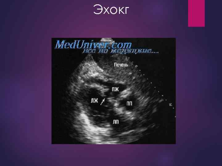Эхокг 