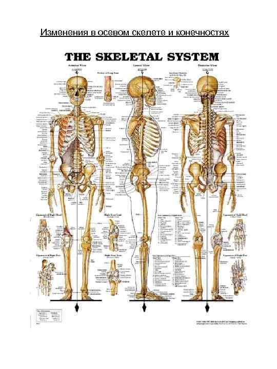 Изменения в осевом скелете и конечностях 