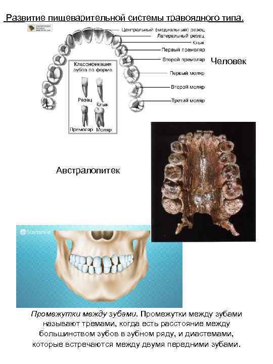  Развитие пищеварительной системы травоядного типа. Человек Австралопитек Промежутки между зубами называют тремами, когда