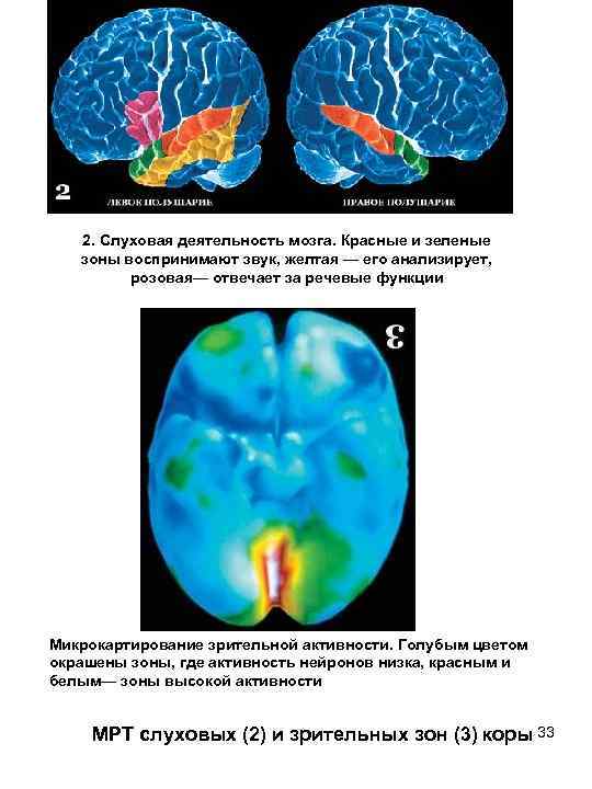 2. Слуховая деятельность мозга. Красные и зеленые зоны воспринимают звук, желтая — его анализирует,