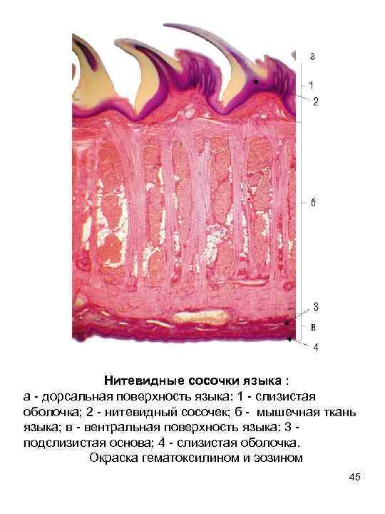 Нитевидные сосочки фото