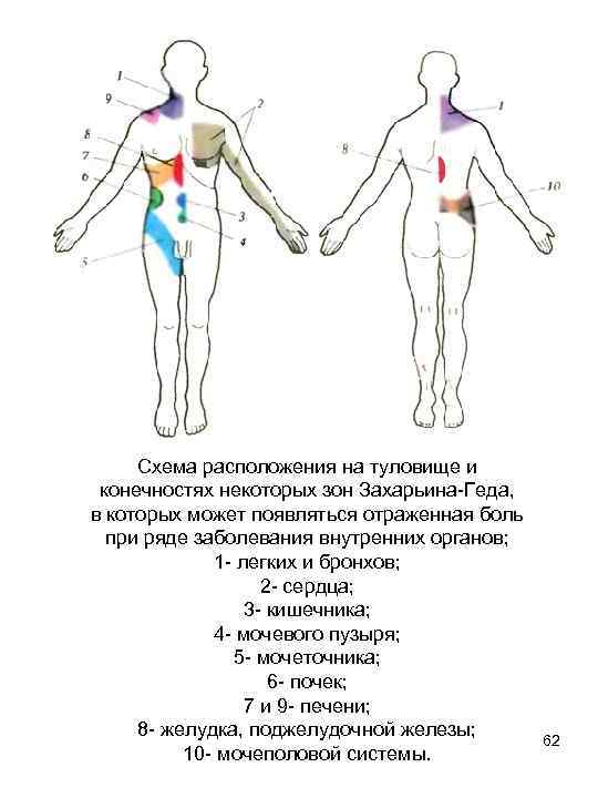 Схема расположения на туловище и конечностях некоторых зон Захарьина-Геда, в которых может появляться отраженная