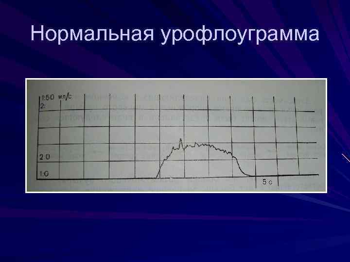 Нейрогенная дисфункция мочевого пузыря код мкб 10