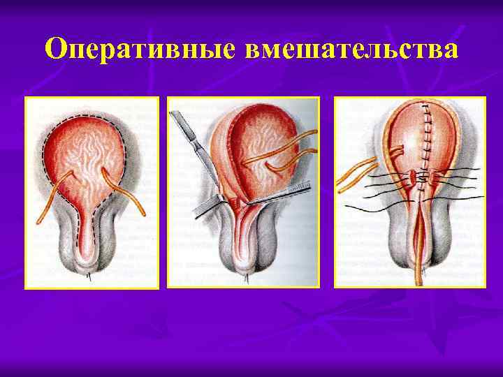 Оперативные вмешательства 