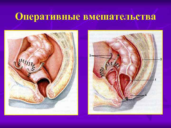 Оперативные вмешательства 