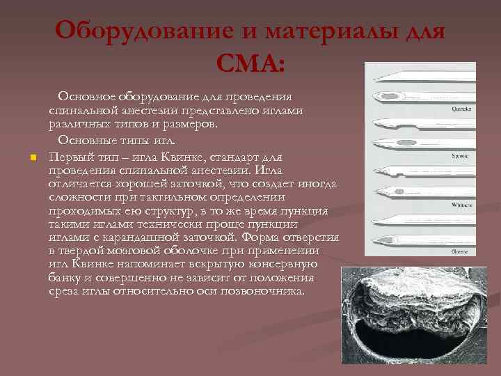 Оборудование и материалы для СМА: n Основное оборудование для проведения спинальной анестезии представлено иглами