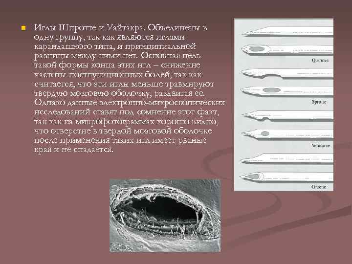 n Иглы Шпротте и Уайтакра. Объединены в одну группу, так как являются иглами карандашного