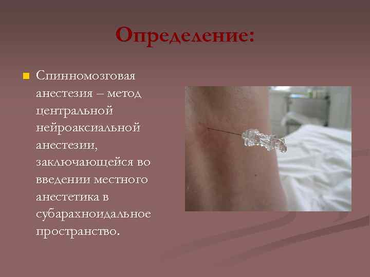 Определение: n Спинномозговая анестезия – метод центральной нейроаксиальной анестезии, заключающейся во введении местного анестетика
