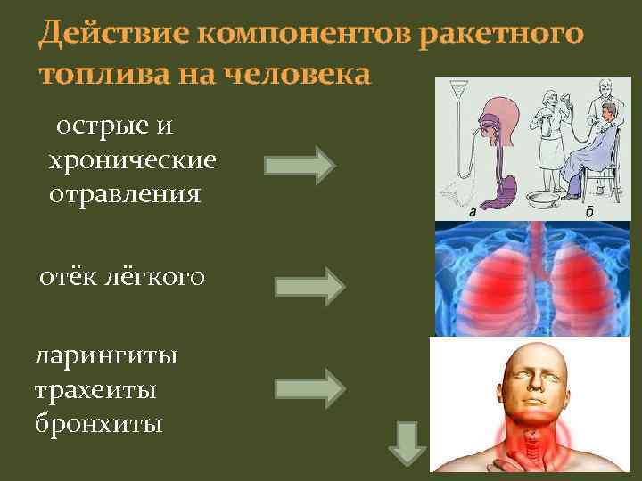 Действие компонентов ракетного топлива на человека острые и хронические отравления отёк лёгкого ларингиты трахеиты