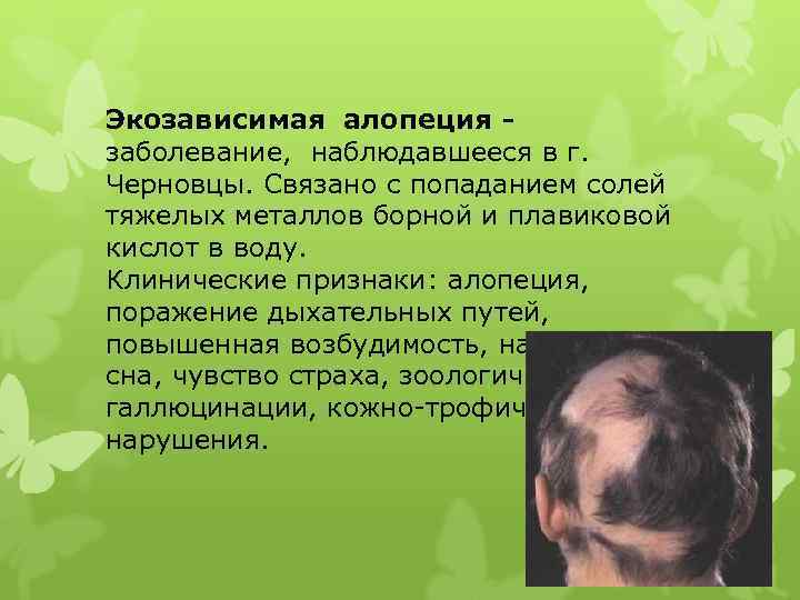 Экозависимая алопеция заболевание, наблюдавшееся в г. Черновцы. Связано с попаданием солей тяжелых металлов борной