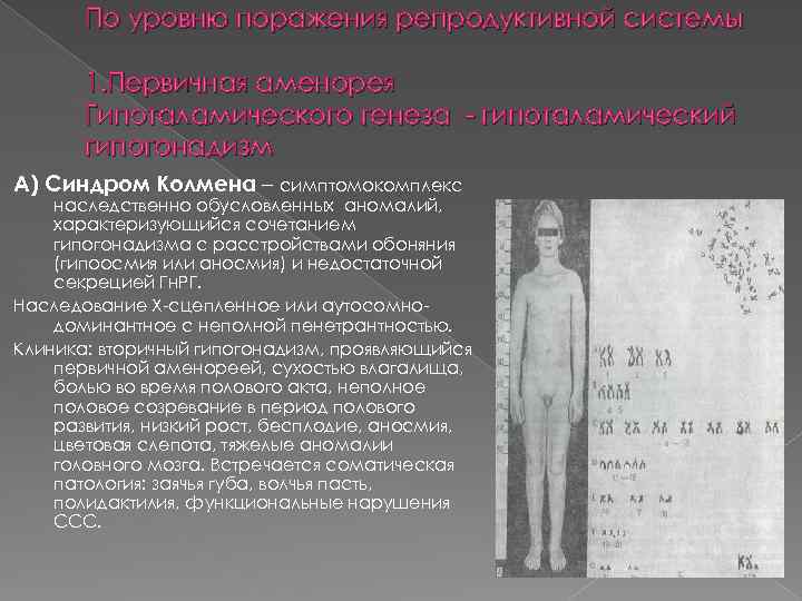 По уровню поражения репродуктивной системы 1. Первичная аменорея Гипоталамического генеза - гипоталамический гипогонадизм А)