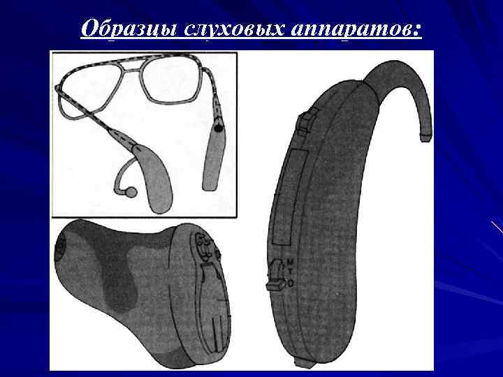 Образцы слуховых аппаратов: 