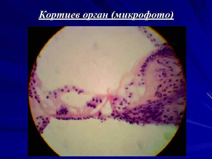 Кортиев орган (микрофото) 