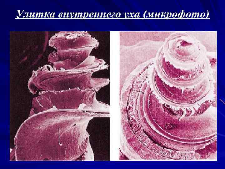 Улитка внутреннего уха (микрофото) 