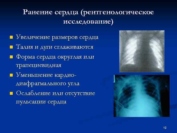 Рентгенологическое исследование сердца. Проникающая травма сердца. В сердце раны в легких никотин