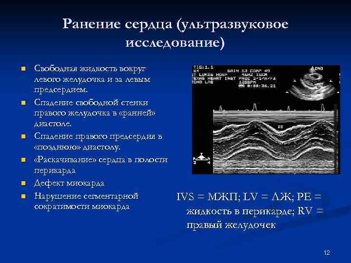 Узи свободная жидкость. Жидкость в перикарде сердца на УЗИ. Жидкость в перикарде на ЭХОКГ. Жидкость в полости перикарда норма. Следы свободной жидкости в полости перикарда это.