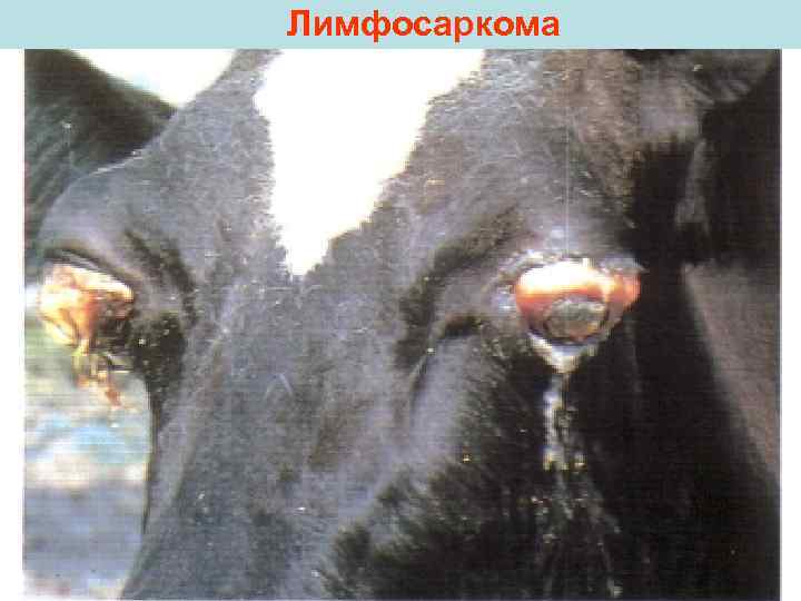 Лимфосаркома 