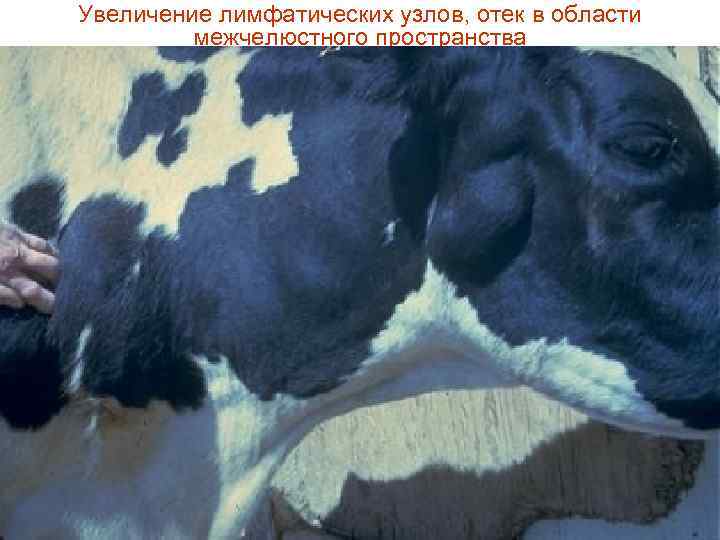 Увеличение лимфатических узлов, отек в области межчелюстного пространства 