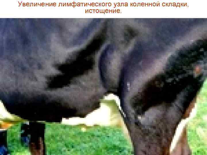 Увеличение лимфатического узла коленной складки, истощение. 