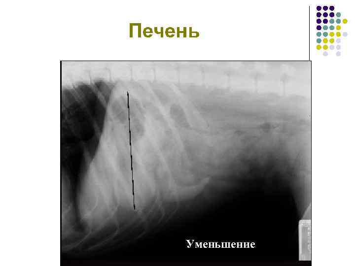 Печень Уменьшение 