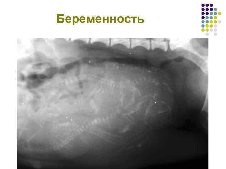 Беременность 