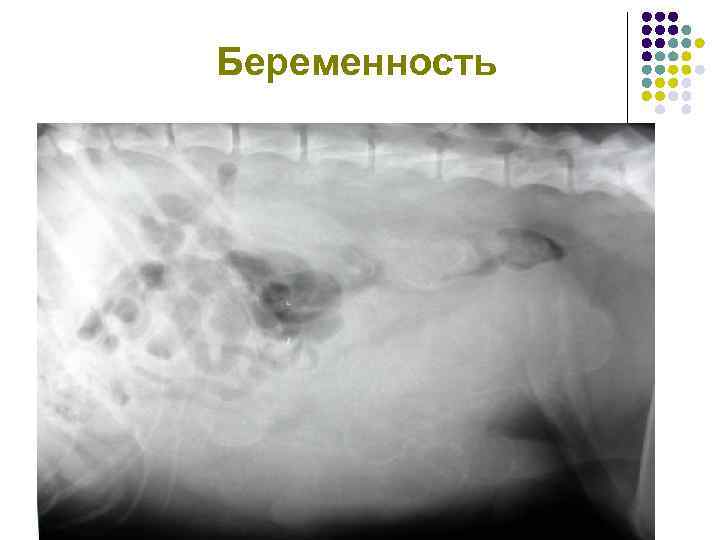 Беременность 