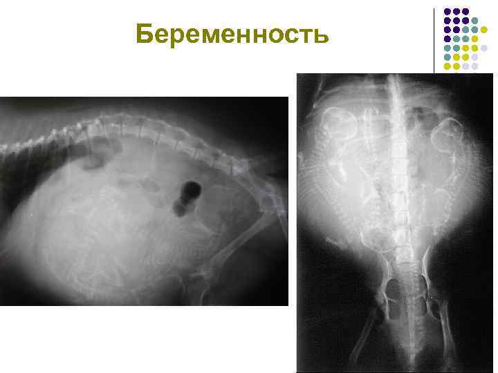 Беременность 