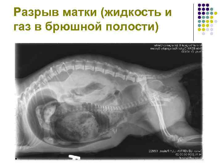 Матка поднялась. Ребенок развивается в брюшной полости. Эмбрион в брюшной полости. Беременность в брюшной полости.