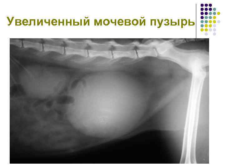Увеличенный мочевой пузырь 