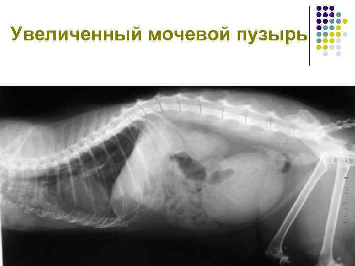 Увеличенный мочевой пузырь 