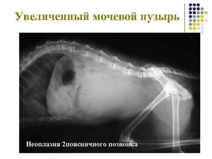 Увеличенный мочевой пузырь Неоплазия 2 поясничного позвонка 