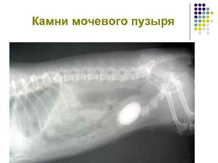 Камни мочевого пузыря 