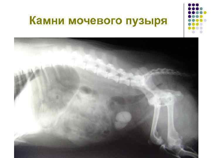 Камни мочевого пузыря 