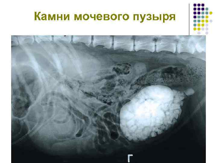Камни мочевого пузыря 