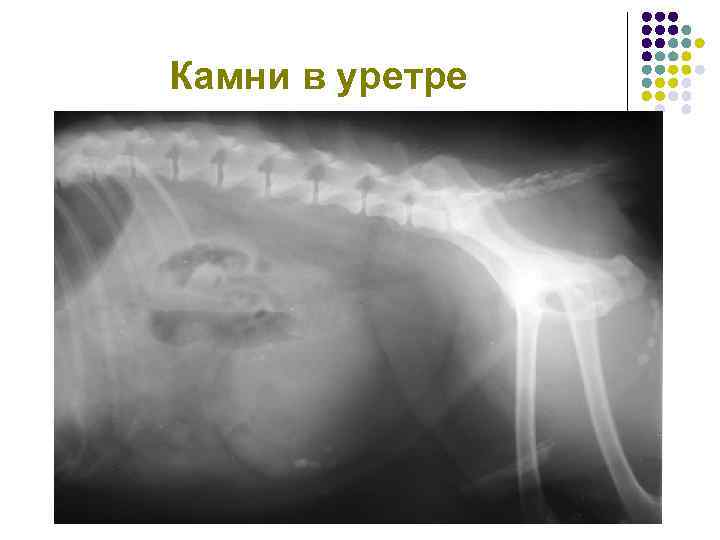 Камни в уретре 