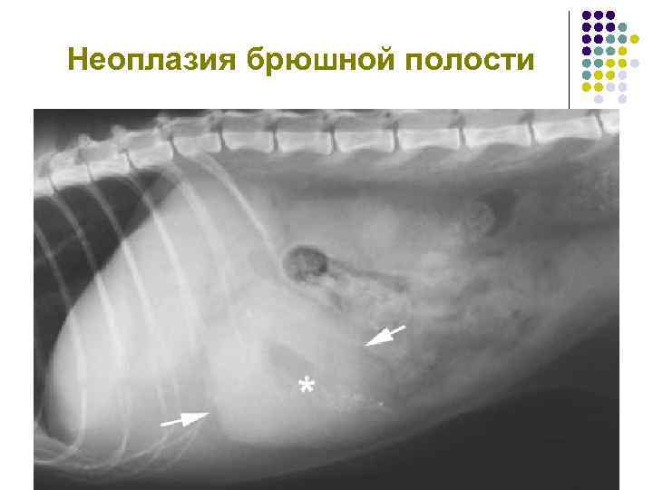 Неоплазия брюшной полости 