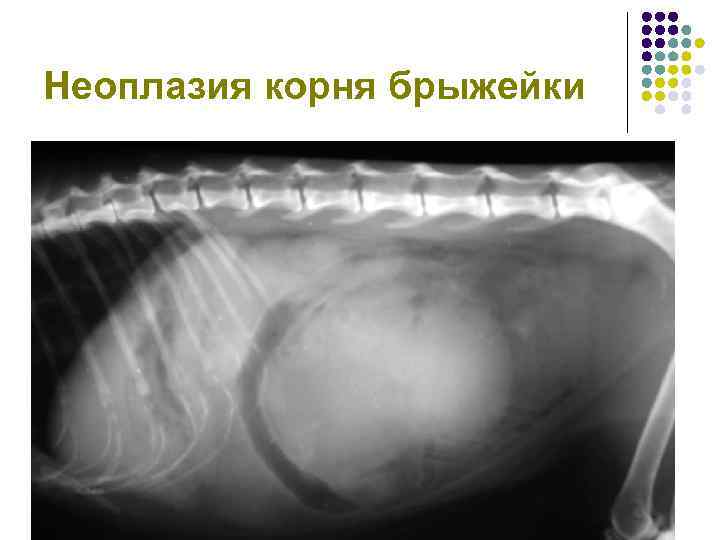 Неоплазия корня брыжейки 